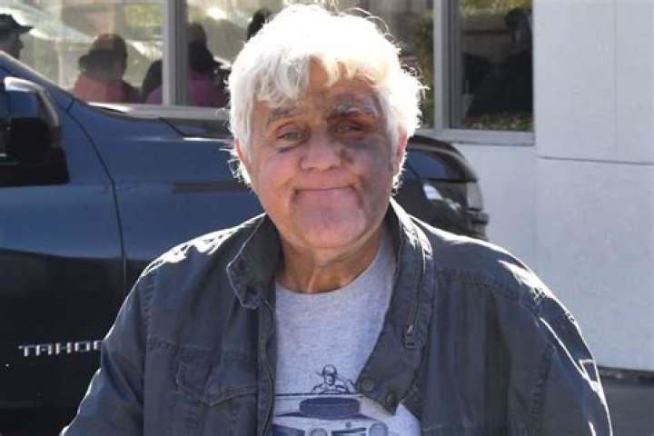Michoel Schnitzler Passed Away, What Happened to Him? Who Was Michoel Schnitzler?